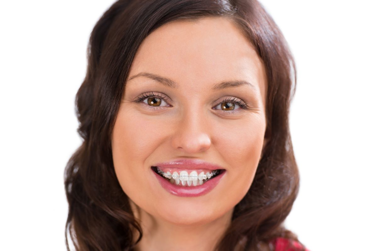 woman smiling clear braces